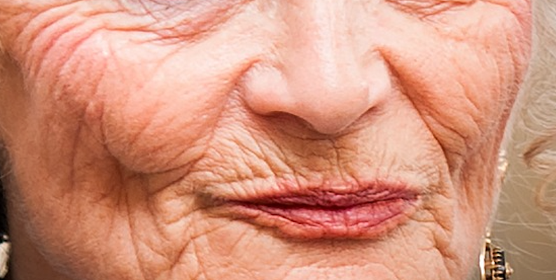 What makes you look older than wrinkles?